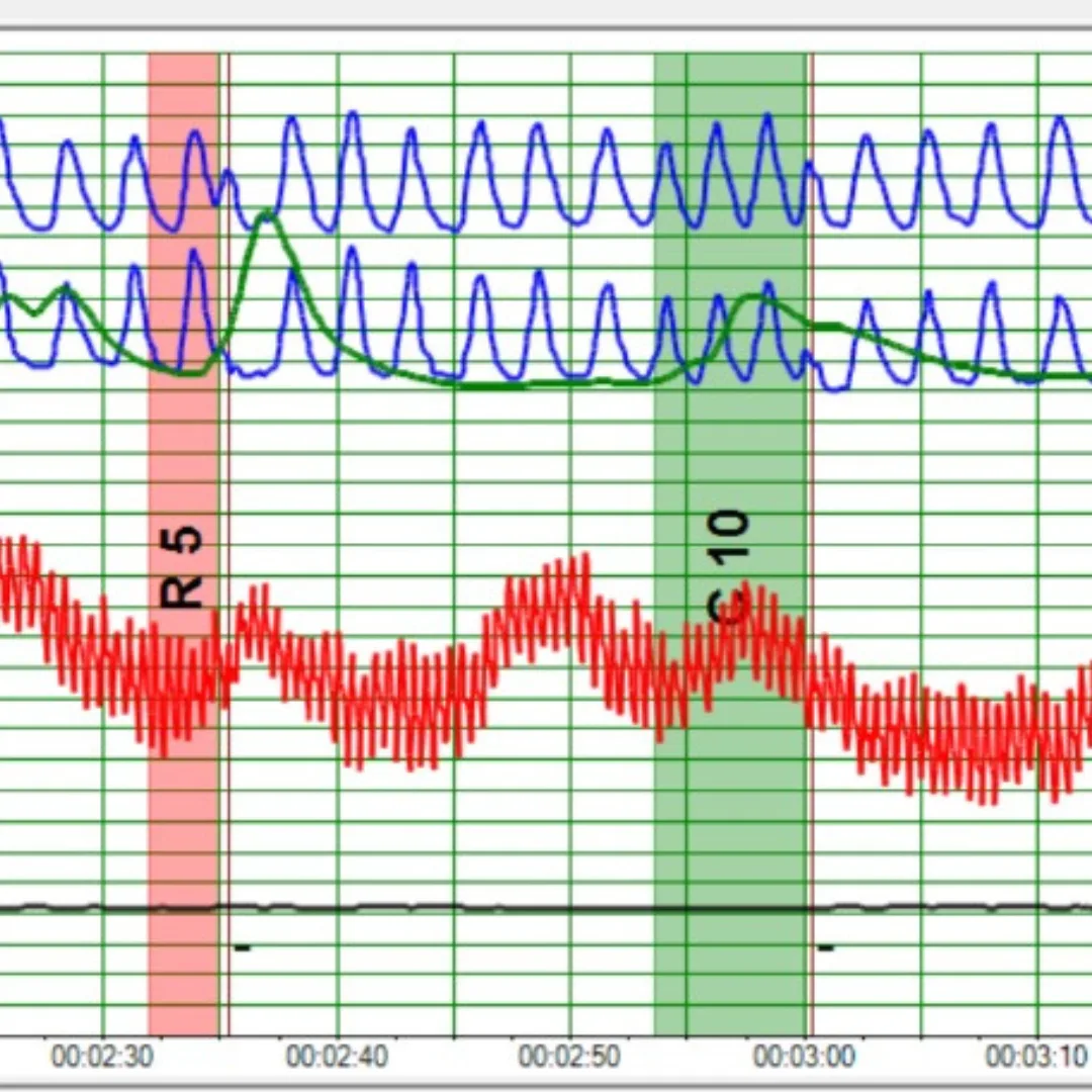 Sistema de Calificación ESS-M