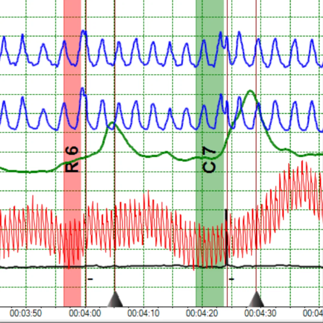 Técnicas Poligráficas